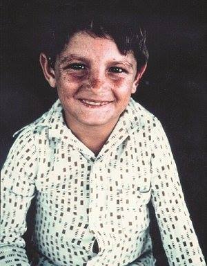 Анхель, больной хореей Гентингтона мальчик из венесуэльской деревни Лагунета, обладатель исключительно длинного полиглутаминового тракта в патологическом гене, вызывающем развитие ХГ. Прожил 11 лет. Благодаря его генетическому материалу был открыт сам патологический ген и лекарственные препараты для его нейтрализации.